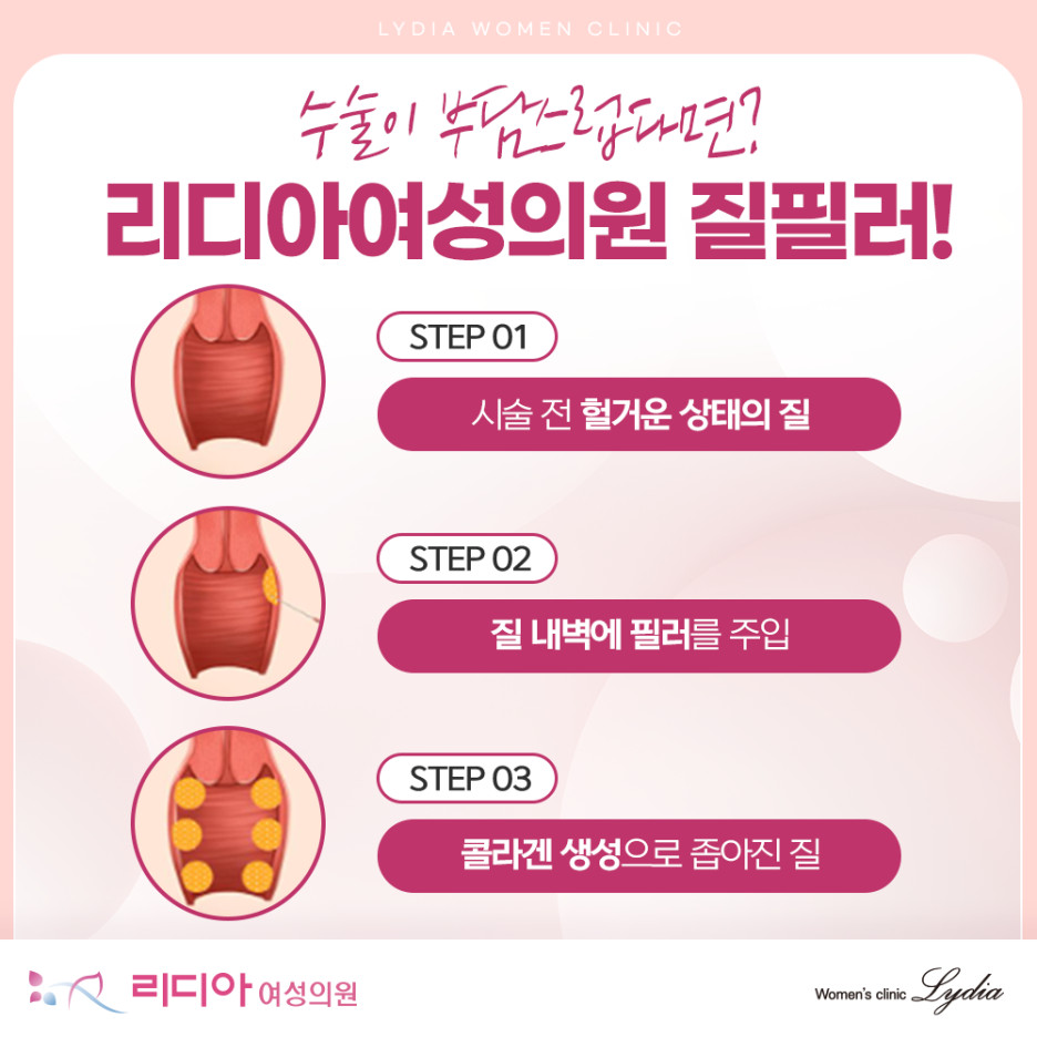 강남질필러 상담 전 임신 출산 노화로 생기는 질 이완 가려움 냄새 주의