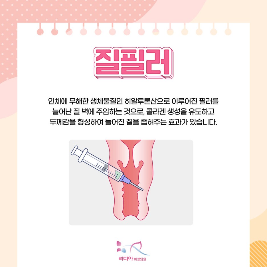 강남질필러 치료 전 질이완증 정의와 질 점막 주변 근육 이완