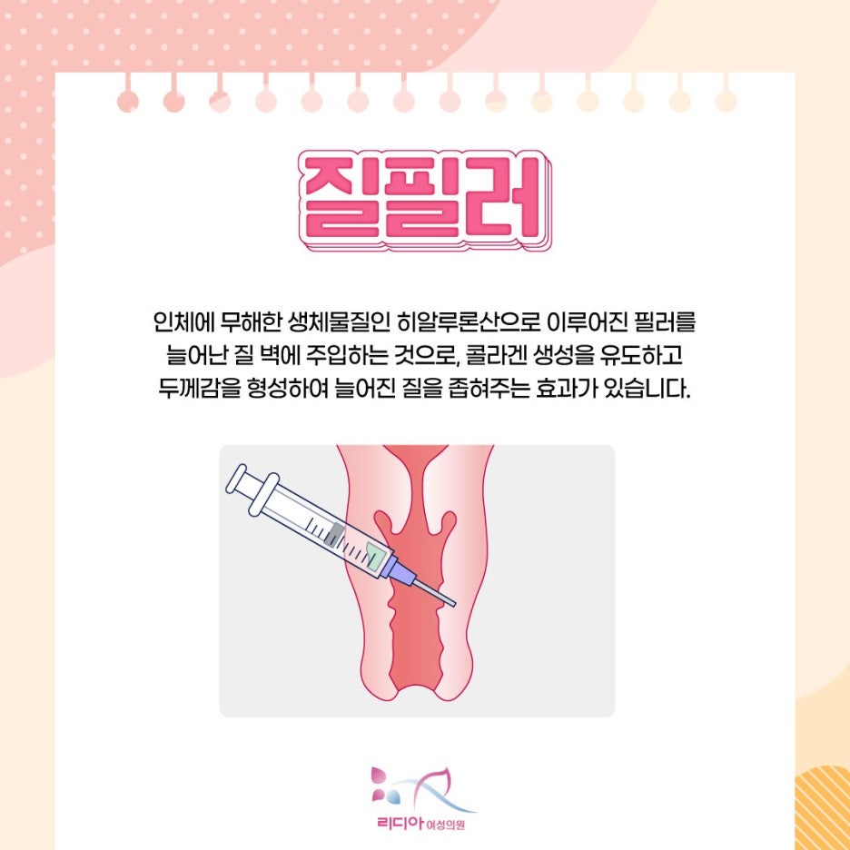 질 점막과 주변 근육의 이완 상태를 확인하는 진료