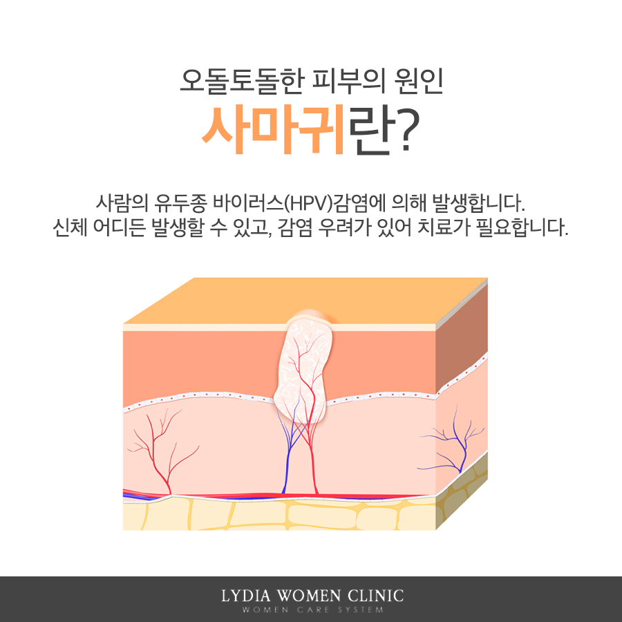 관리해도 번지는 피부 병변을 확인하는 과정
