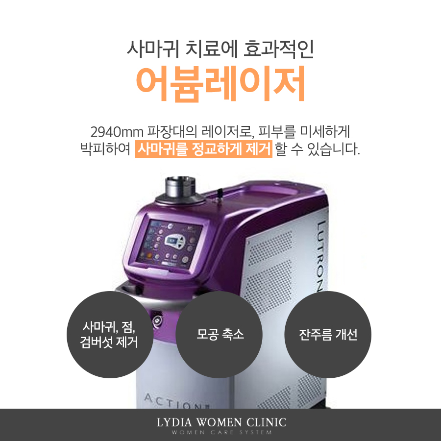 바이러스성 피부질환인 사마귀를 구분하는 기준