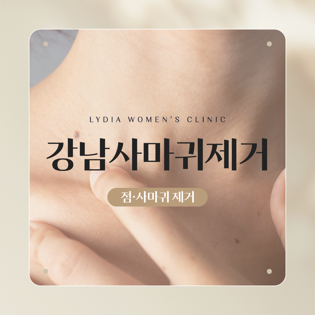 강남사마귀제거